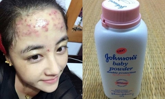 Bỏ 30k mua lọ phấn rôm mà có tới 7 công dụng làm đẹp bất bại - Ảnh 6 Bỏ 30k mua lọ phấn rôm mà có tới 7 công dụng làm đẹp bất bại - Ảnh 6