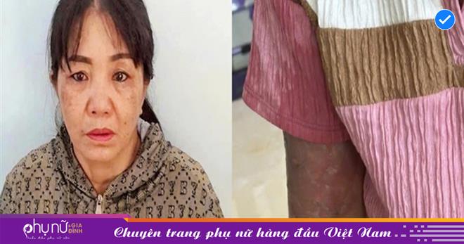 Kiên Giang Khởi tố mẹ nuôi tạt nước sôi vào bé gái 12 tuổi vì làm mất