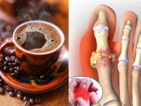 4 loại thực phẩm tốt nhất cho người bị gút để giảm đau hiệu quả 4 loại thực phẩm tốt nhất cho người bị gút để giảm đau hiệu quả