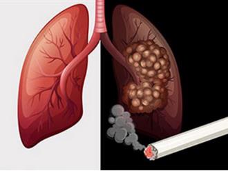 Vì sao nhiều người hút thuốc lâu năm vẫn không bị ung thư phổi?