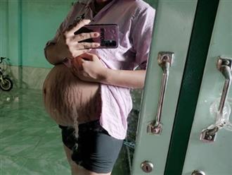 Thai phụ 9x đăng ảnh khoe bầu vượt mặt, cộng đồng mẹ bỉm sữa 'nhìn mà thấy thương xót vô cùng'