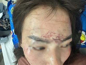 Hé lộ nguyên nhân người phụ nữ đi đường bất ngờ bị kéo lên ô tô, 'tra tấn' bằng axit và máy xăm